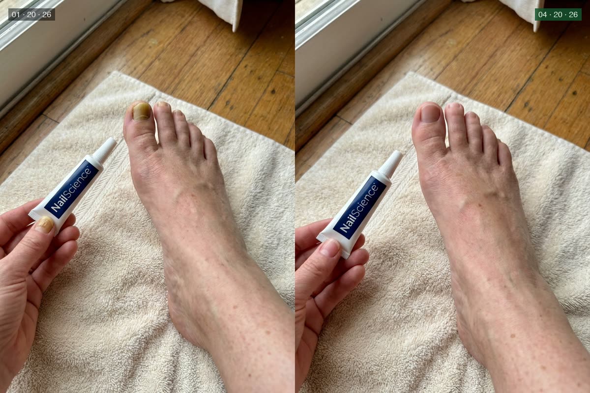 Customer 1 — before and after 90 days