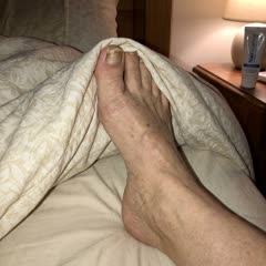 Sharon's toenail — before