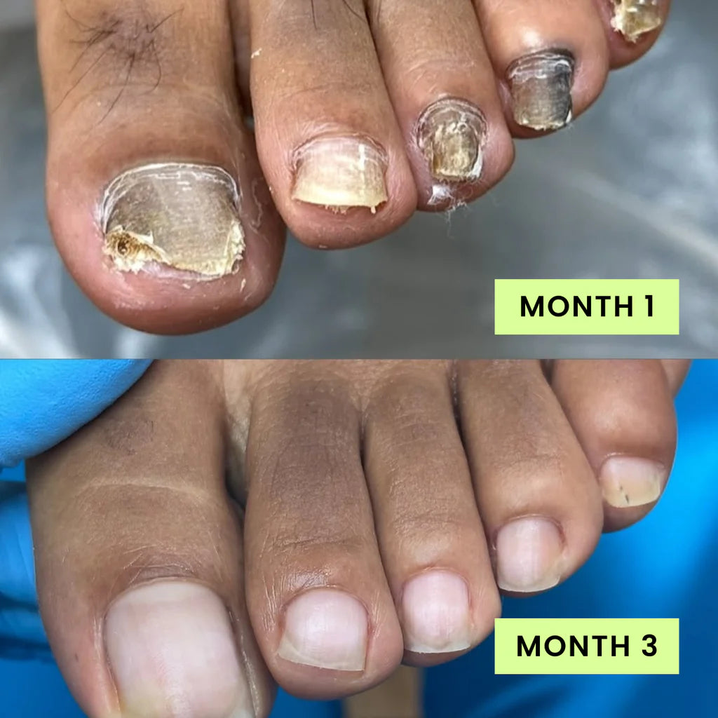 Before and after treatment